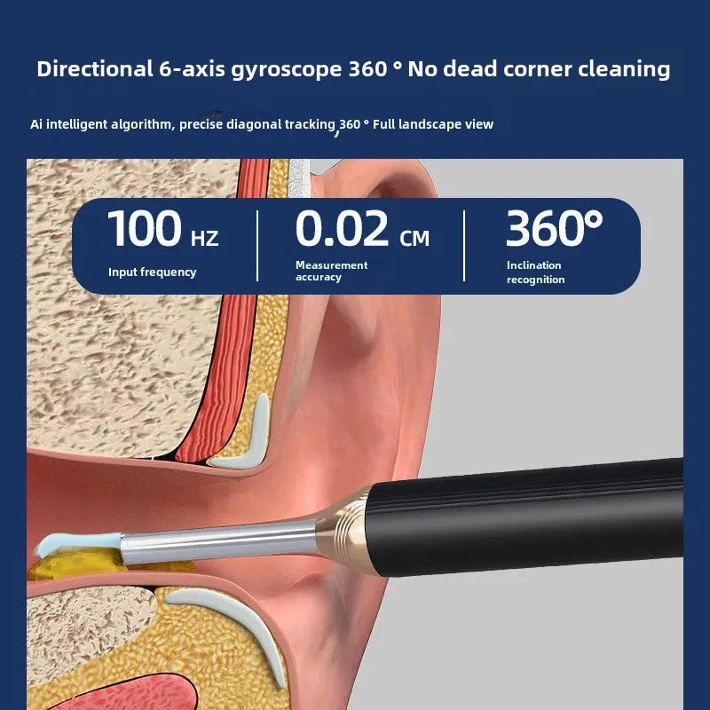 Wow SL0011WIFI version of the visual ear digging spoon HD luminous integrated spoon ear canal cleaning visual ear picking