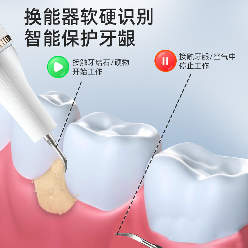 Ultrasonic dental scaler, special calculus, electric convenient dental scaler, multi-functional tooth whitening and dental scaler